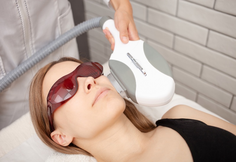 IPL Photorejuvenation Laser Treatment in Chicago IL